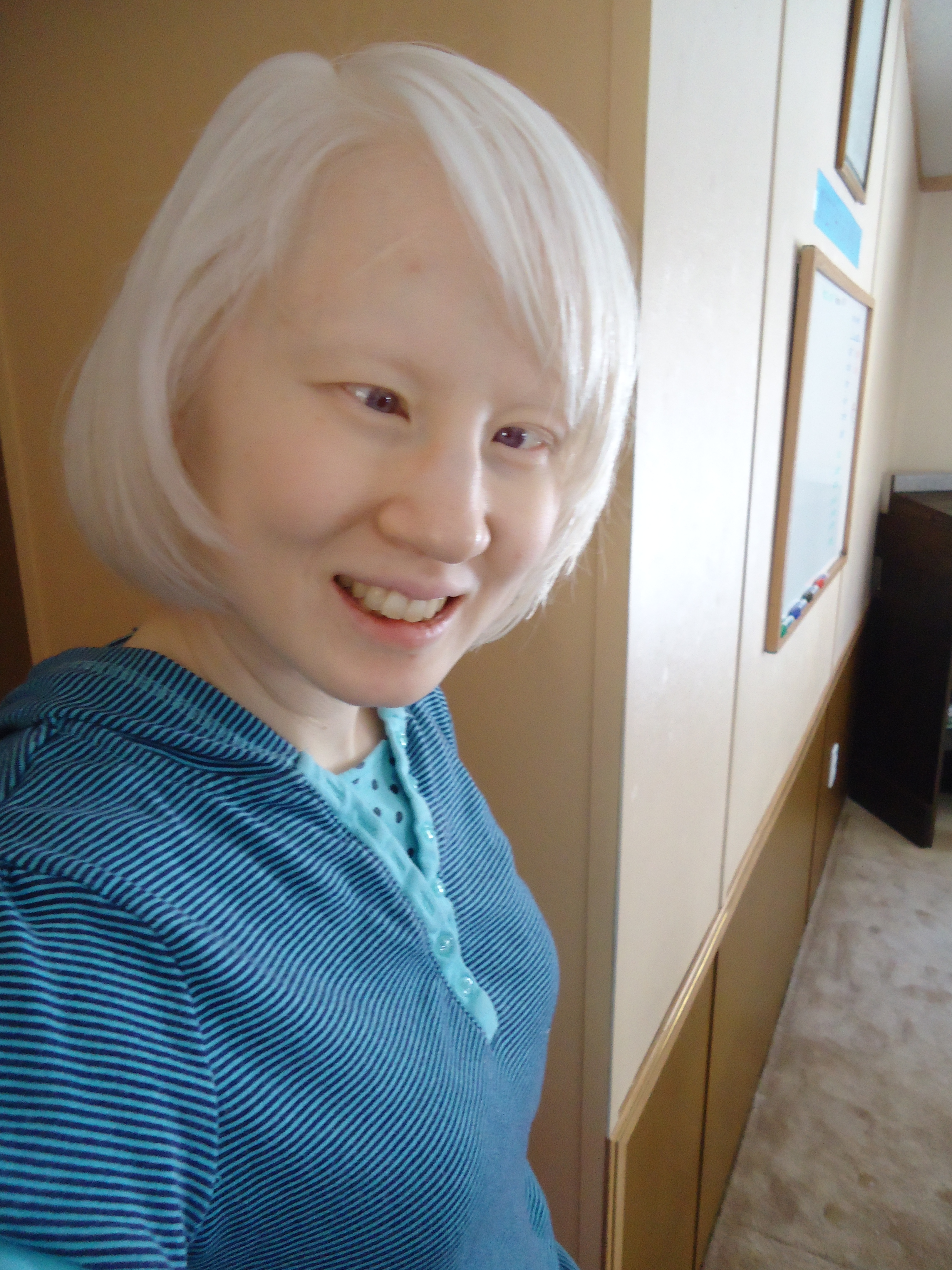Albino Asian People 74